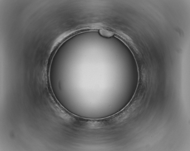 X0000111531176200907141522