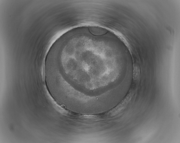 X0000111531295200907141520