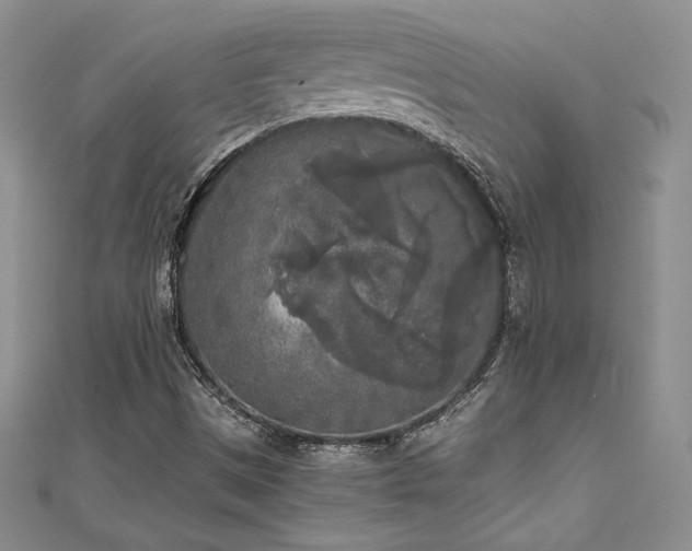 X0000111531497200907141517