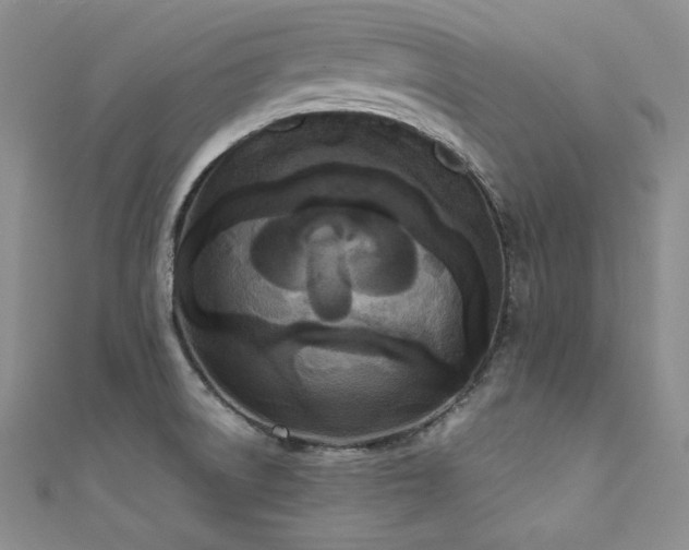 X0000111531522200907141518