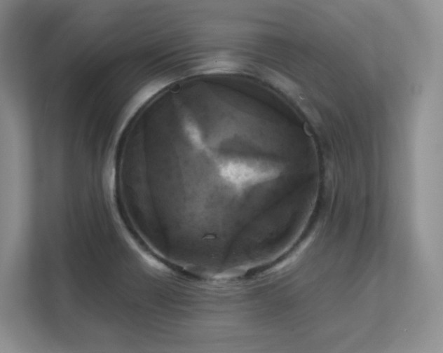 X0000111531418200907211235