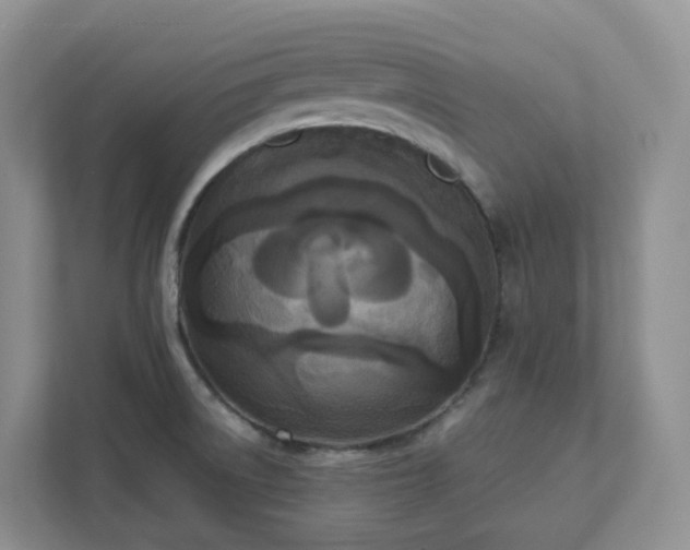 X0000111531522200907211234