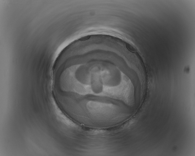 X0000111531522200907281350