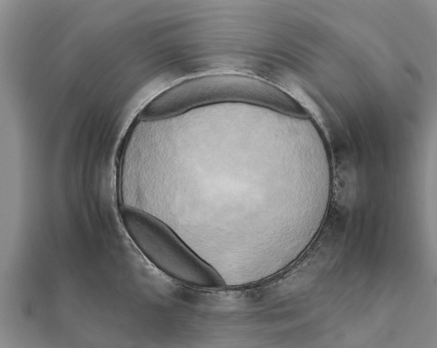 X0000111531096200908041300