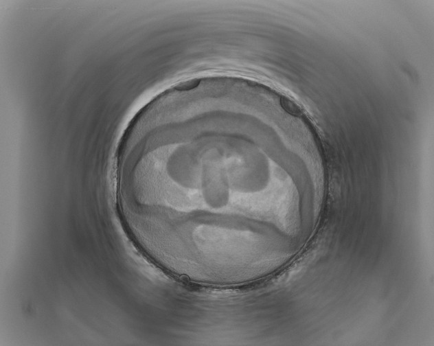 X0000111531522200908041254