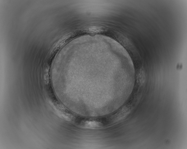 X0000111530360200908111232