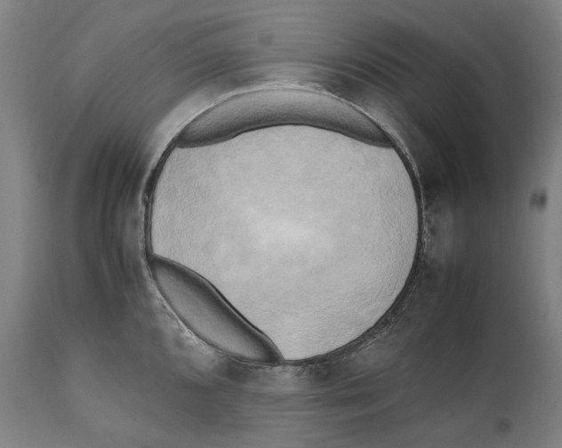 X0000111531096200908111220