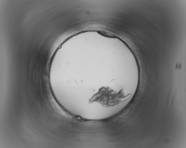 X0000111531392200908111215