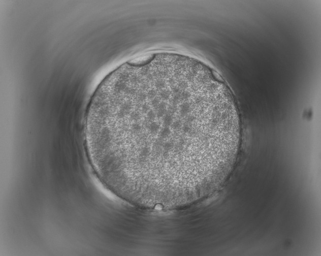 X0000111531519200908251150