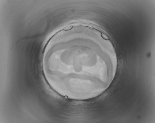 X0000111531522200908251150