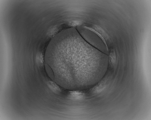 X0000111580380200907161430