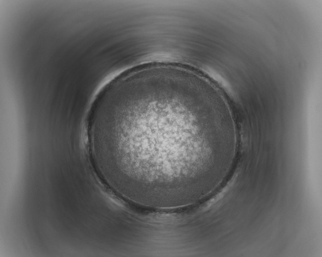 X0000111581070200907161420