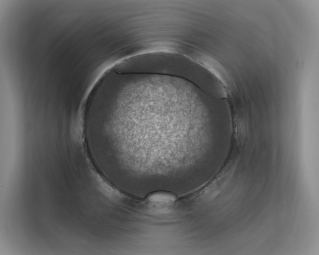 X0000111581116200907161419