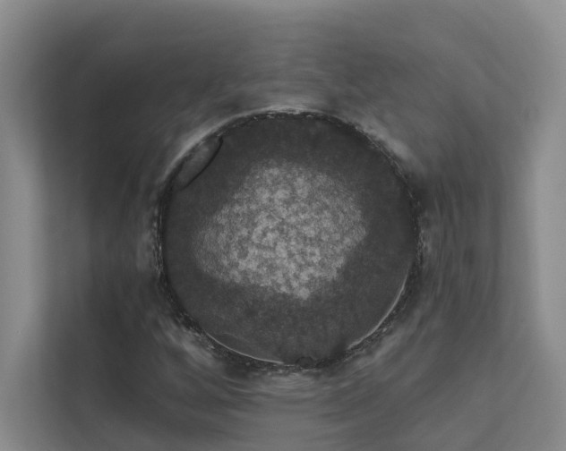 X0000111581256200907161418