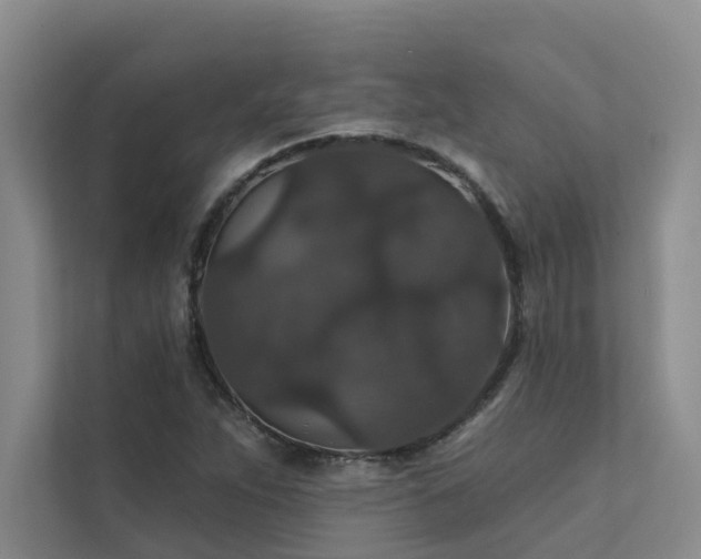 X0000111581263200907161418