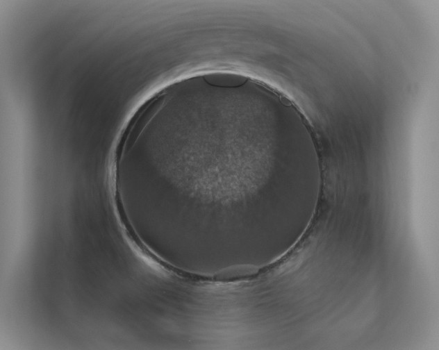 X0000111581519200907161414