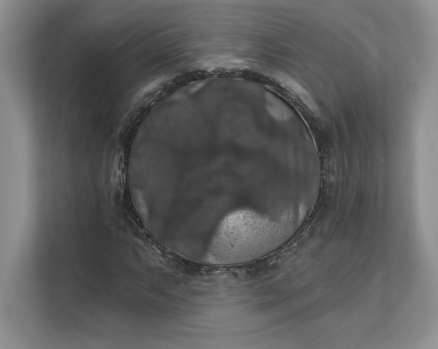 X0000111581063200907301400