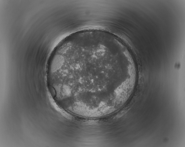 X0000111581038200908061320