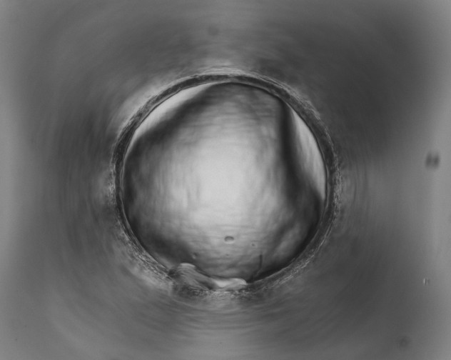 X0000111581167200908061318