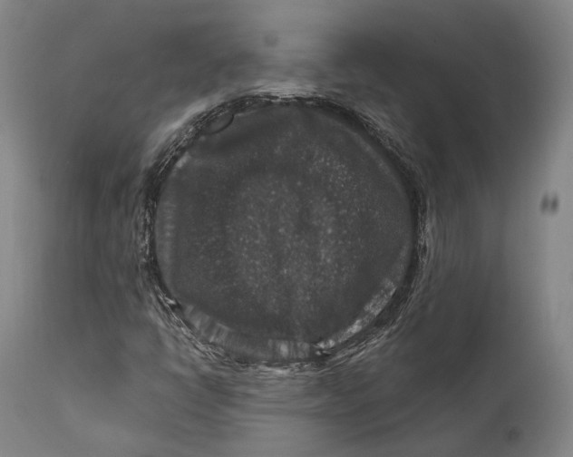 X0000111581398200908061314