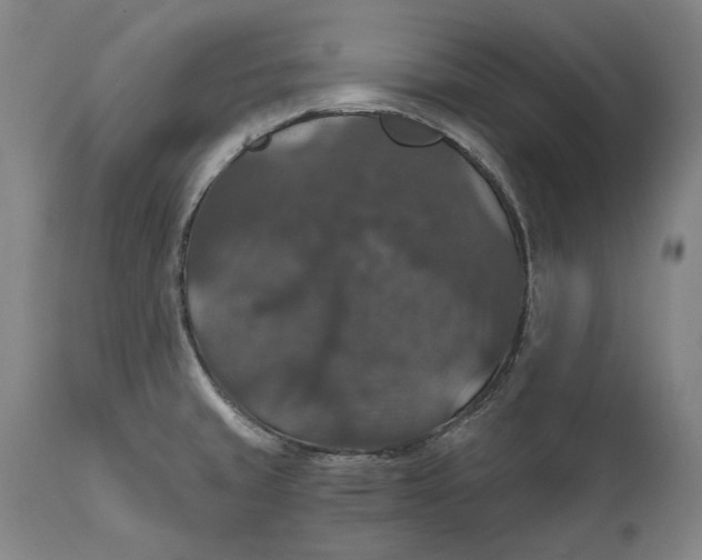 X0000111581429200908061314