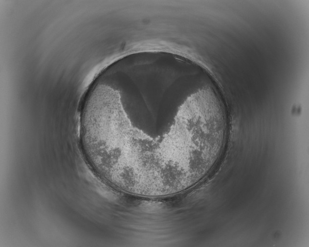 X0000111581509200908061312