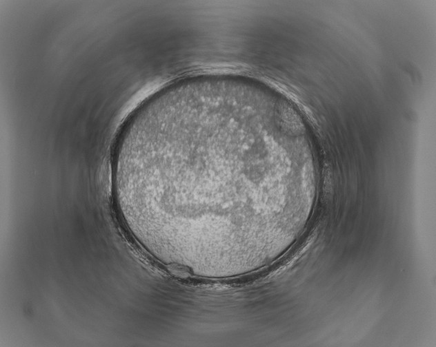 X0000111581317200908131310