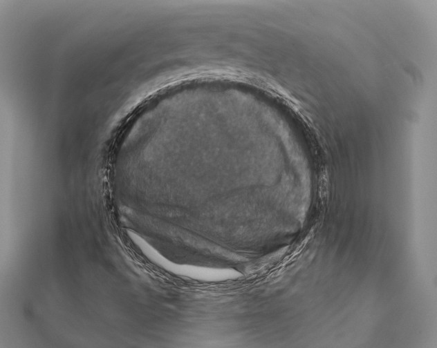 X0000111581496200908131307