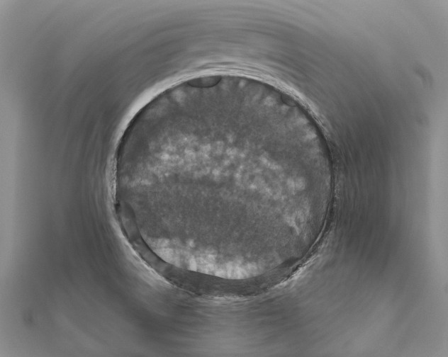 X0000111581522200908131307