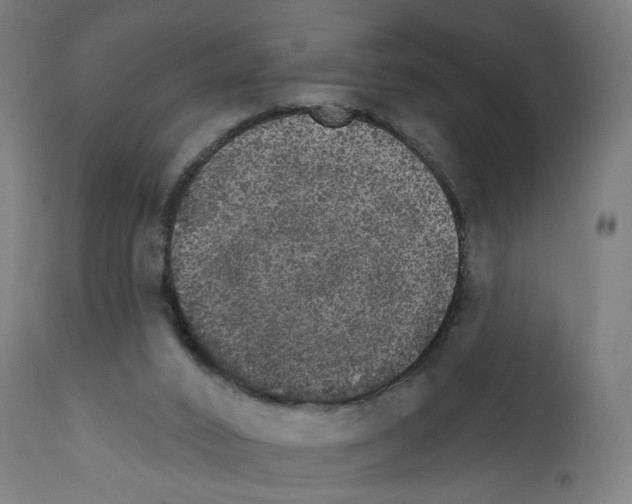 X0000111580016200908271046