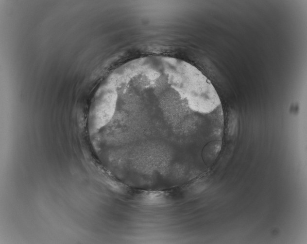 X0000111580569200908271038