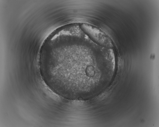 X0000111581068200908271030