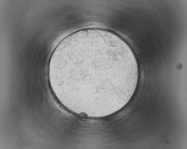 X0000111581375200908271025