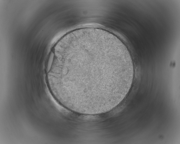 X0000111581430200908271025