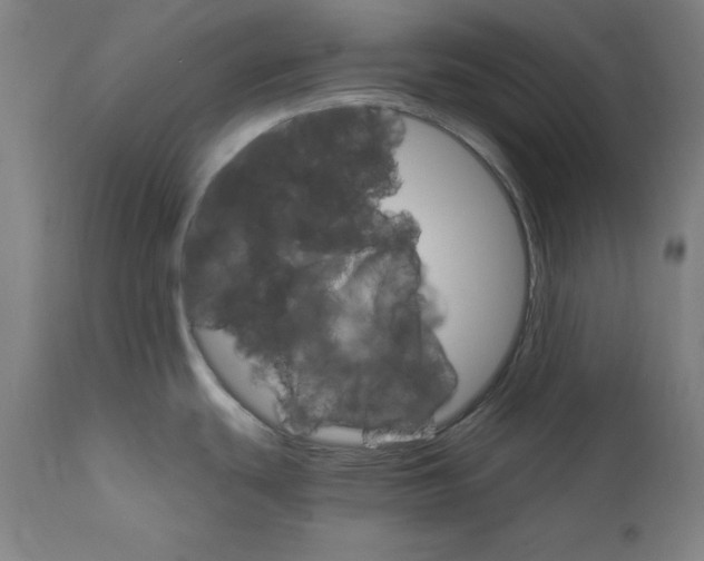 X0000111581439200908271025