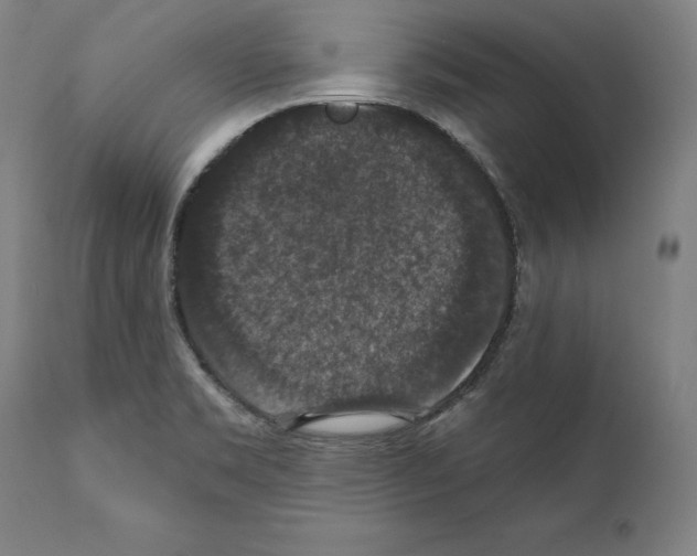 X0000111581469200908271024