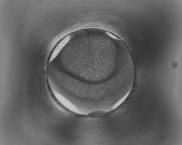 X0000111581519200908271023