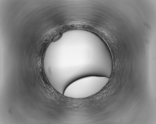 X0000111591062200907161148