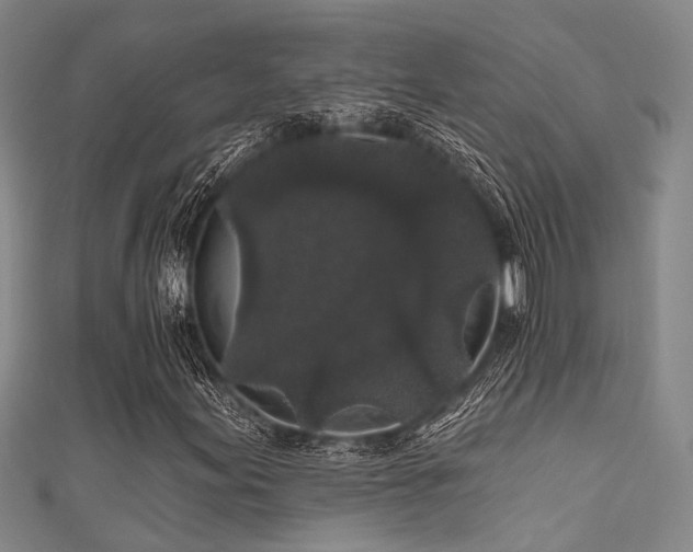 X0000111591155200907161447