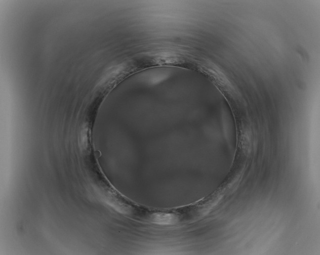 X0000111590169200907231222