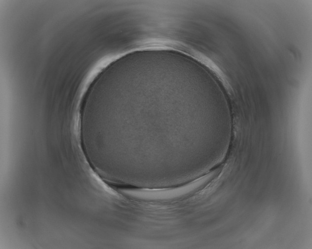 X0000111591472200907231204