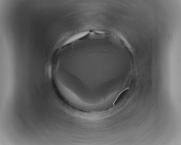 X0000111590019200907301435