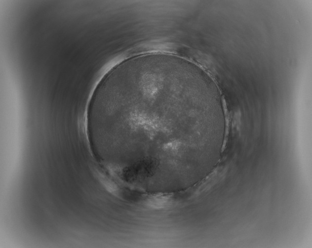 X0000111590148200907301433