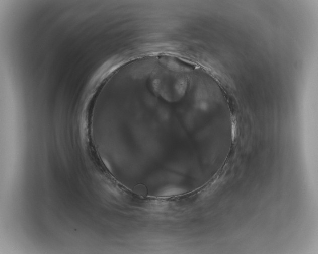 X0000111590339200907301430