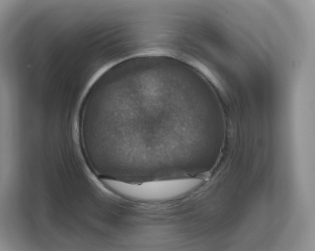 X0000111591468200907301416