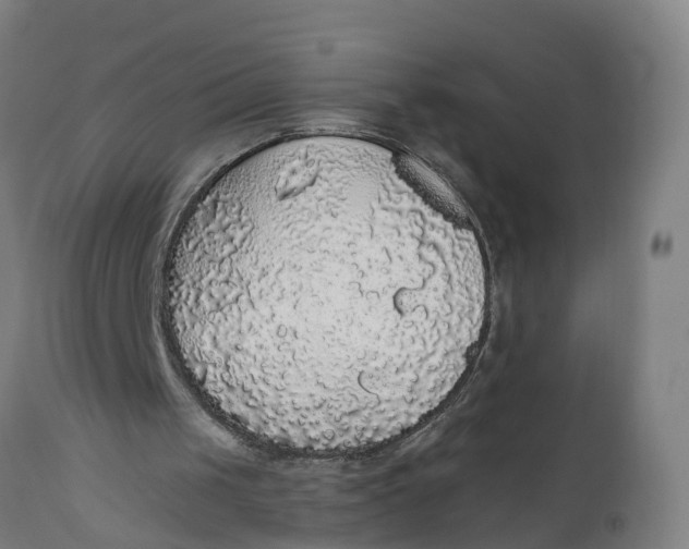 X0000111590049200908061400