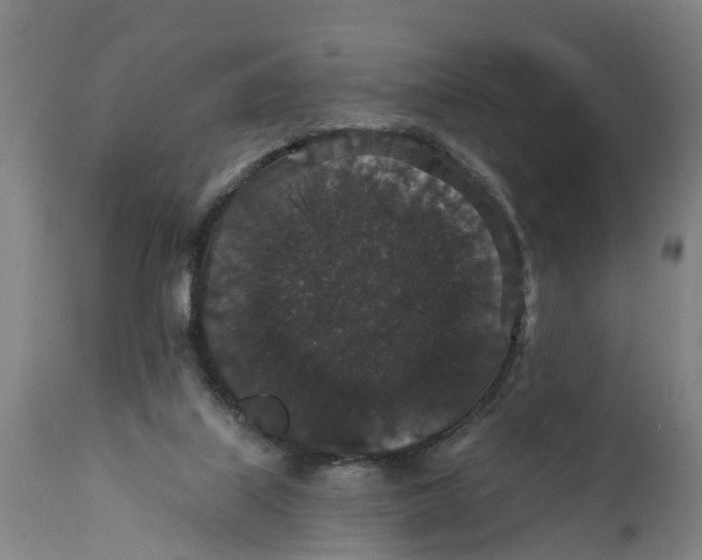 X0000111590067200908061400