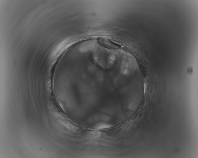 X0000111590339200908061355