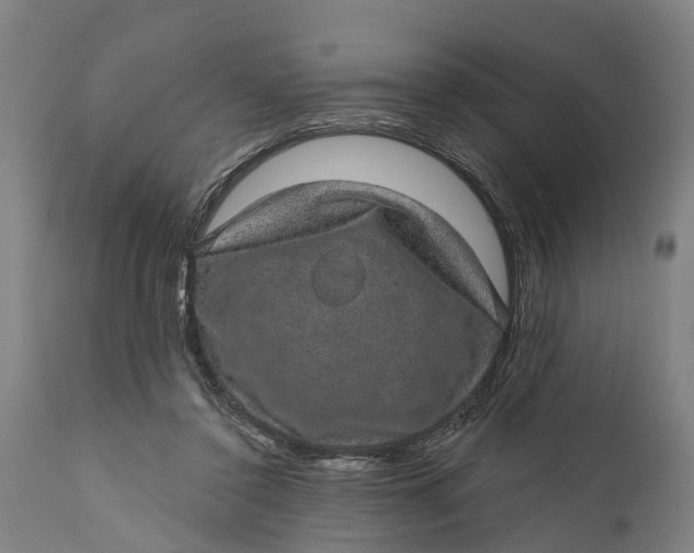 X0000111590356200908061355