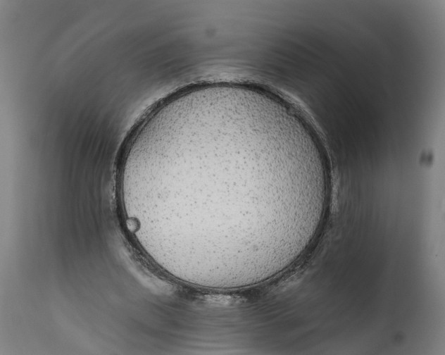 X0000111590439200908061353